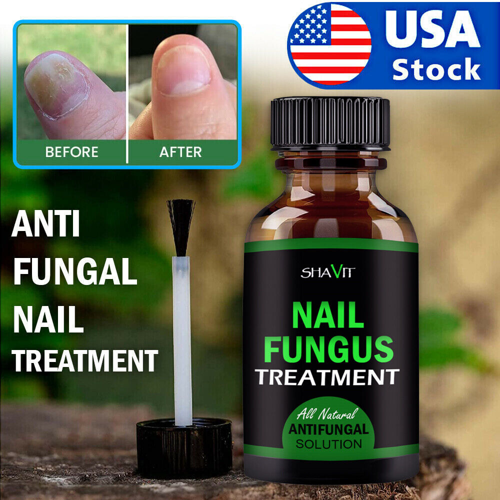 ANTI FUNGAL TREATMENT EXTRA STRENGTH TOENAIL FUNGUS ATHLETES FOOT FUNGI NAIL