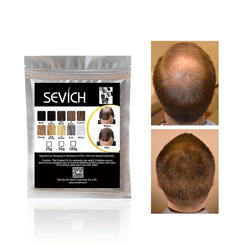 Sevich 50G Fibras para la construcción del cabello Producto corrector para la caída del cabello Extensión del cabello Polvo de fibra de queratina Crecimiento para el cuidado del cabello