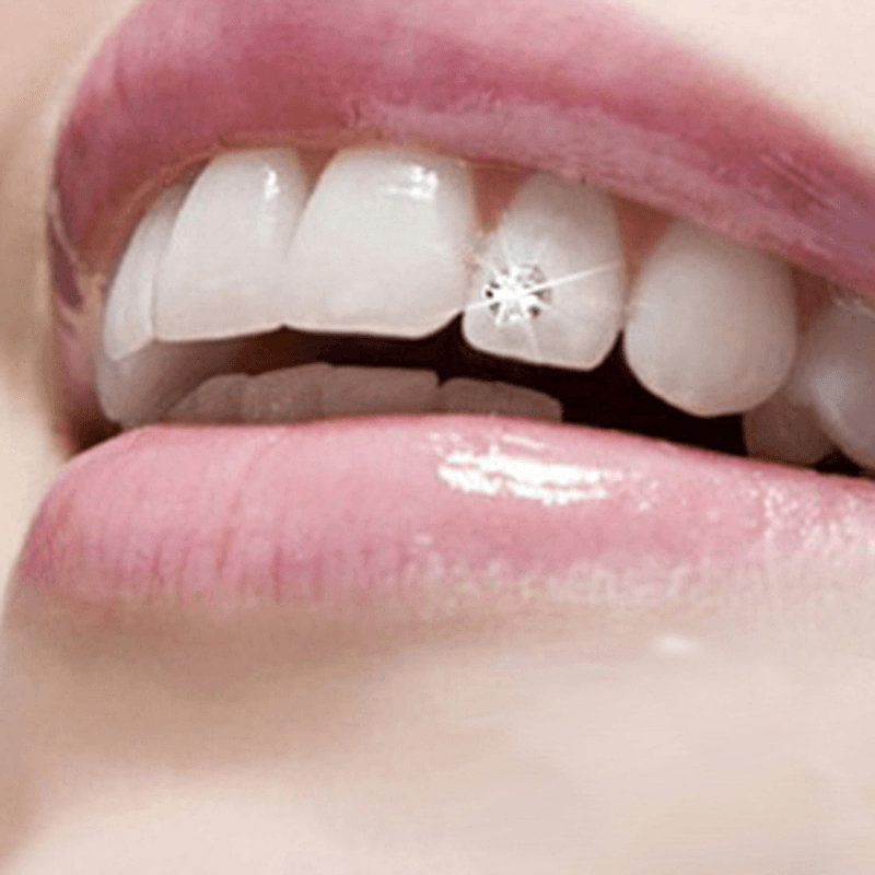 10Pcs Teeth Jewelry Beauty Make up Dental Tools Drill Diamond Crystal Ornament