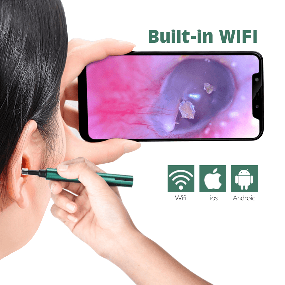 3,0 Mm Drahtlose Wifi Ohr Pick Otoskop Kamera Endoskop Leucht Ohr Wachs Reinigung Zähne Oral Inspektion Gesundheitswesen 3,0/5,0 MP