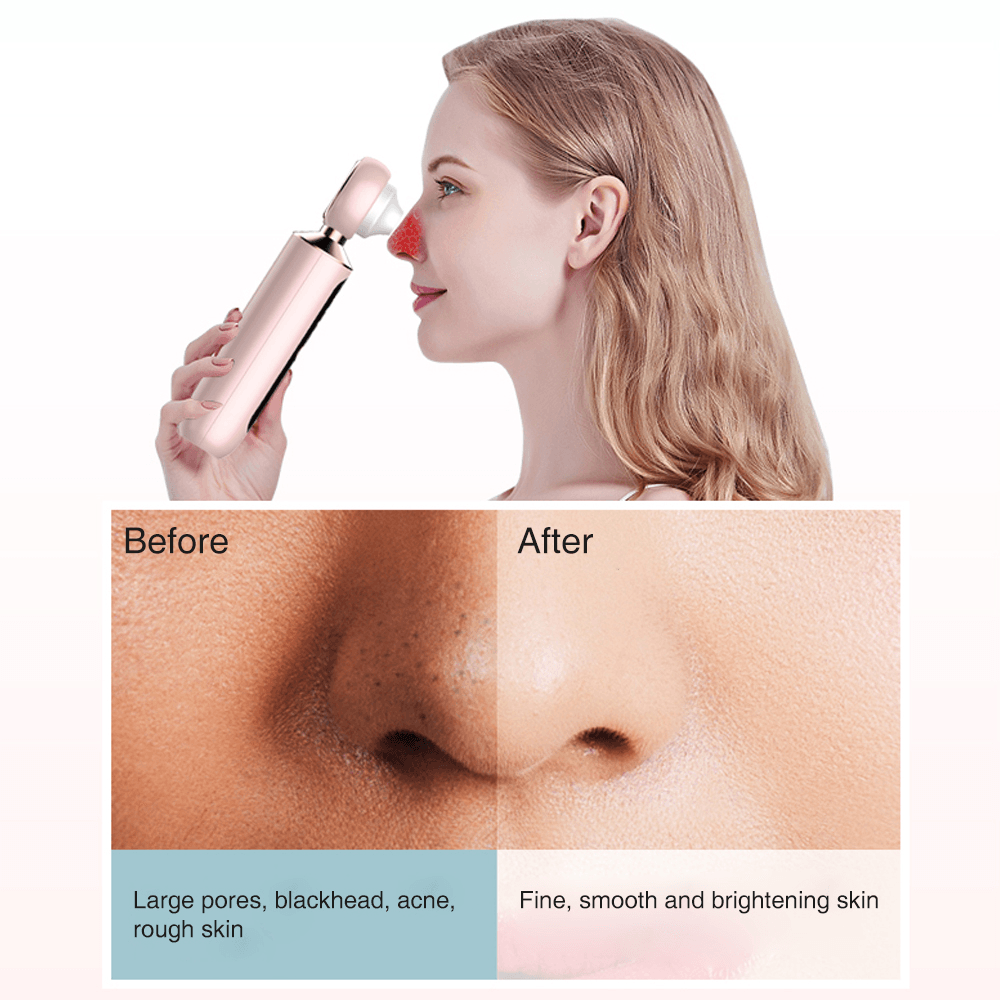 Visual Blackhead Vacuum Remover with Magnifier LED Light Face T Zone Pore Cleaner Acne Black Pimple Electric Blackhead Removal