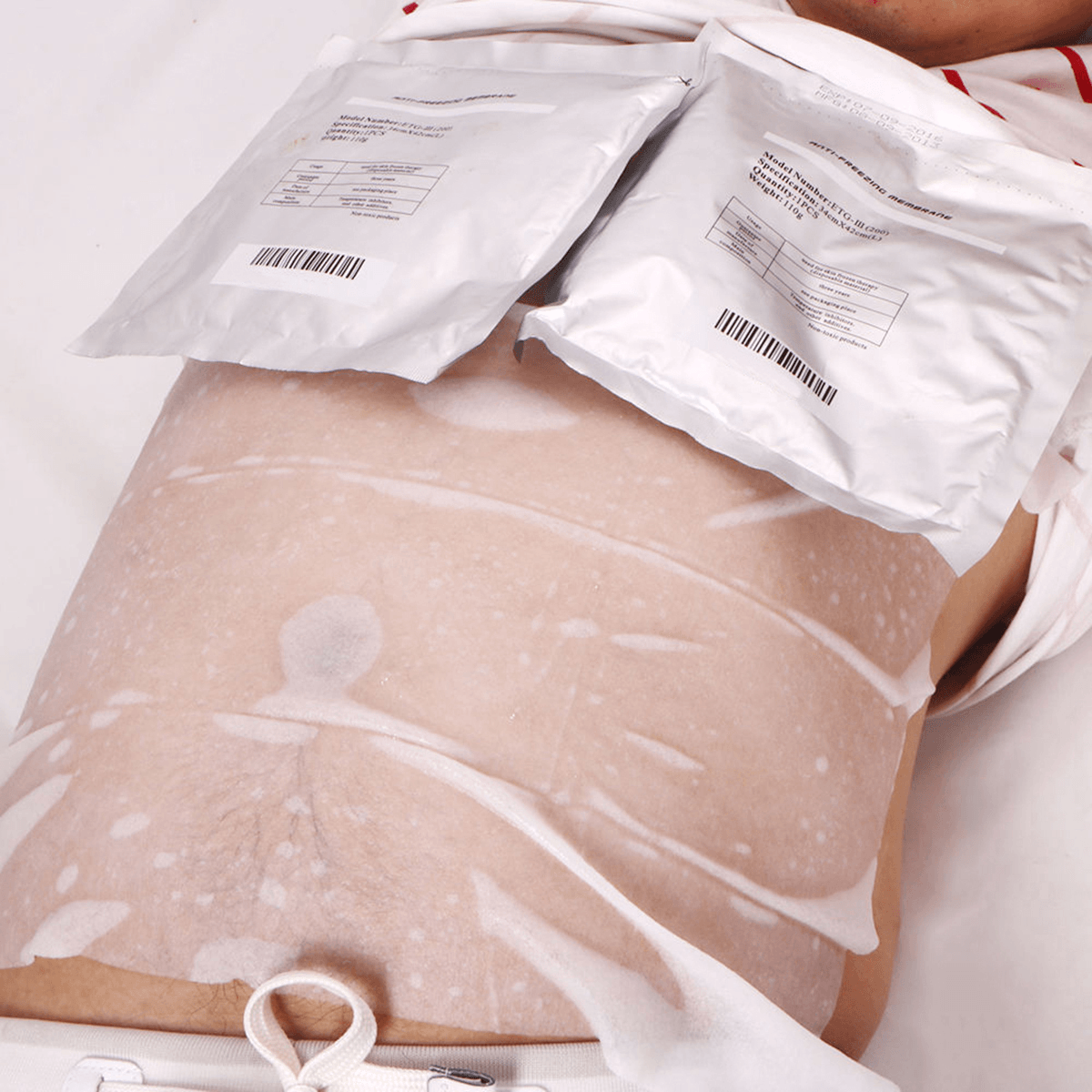 Anti Freeze Membrane Film Paper for Fat Freeze Liposuction Cryotherapy