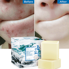 100G Removal Pimple Pore Acne Treatment Sea Salt Soap Cleaner Moisturizing Goat Milk Soap Face Care Wash Basis Soap