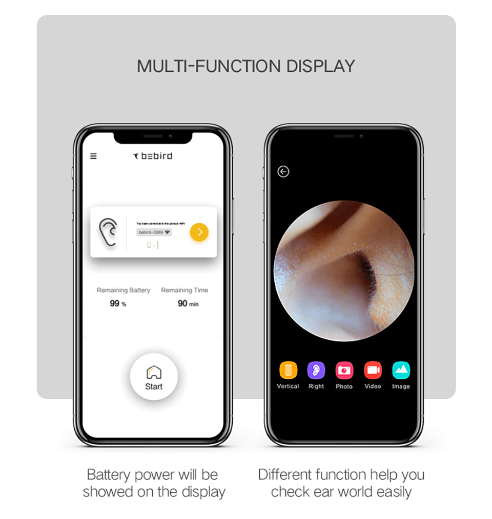 Bebird A2 Smart Visual Ear Stick Wireless In-Ear Cleaning Camera Otoscope Borescope Ear Picker Tool 1080P HD Ear Spoon Earwax Removal