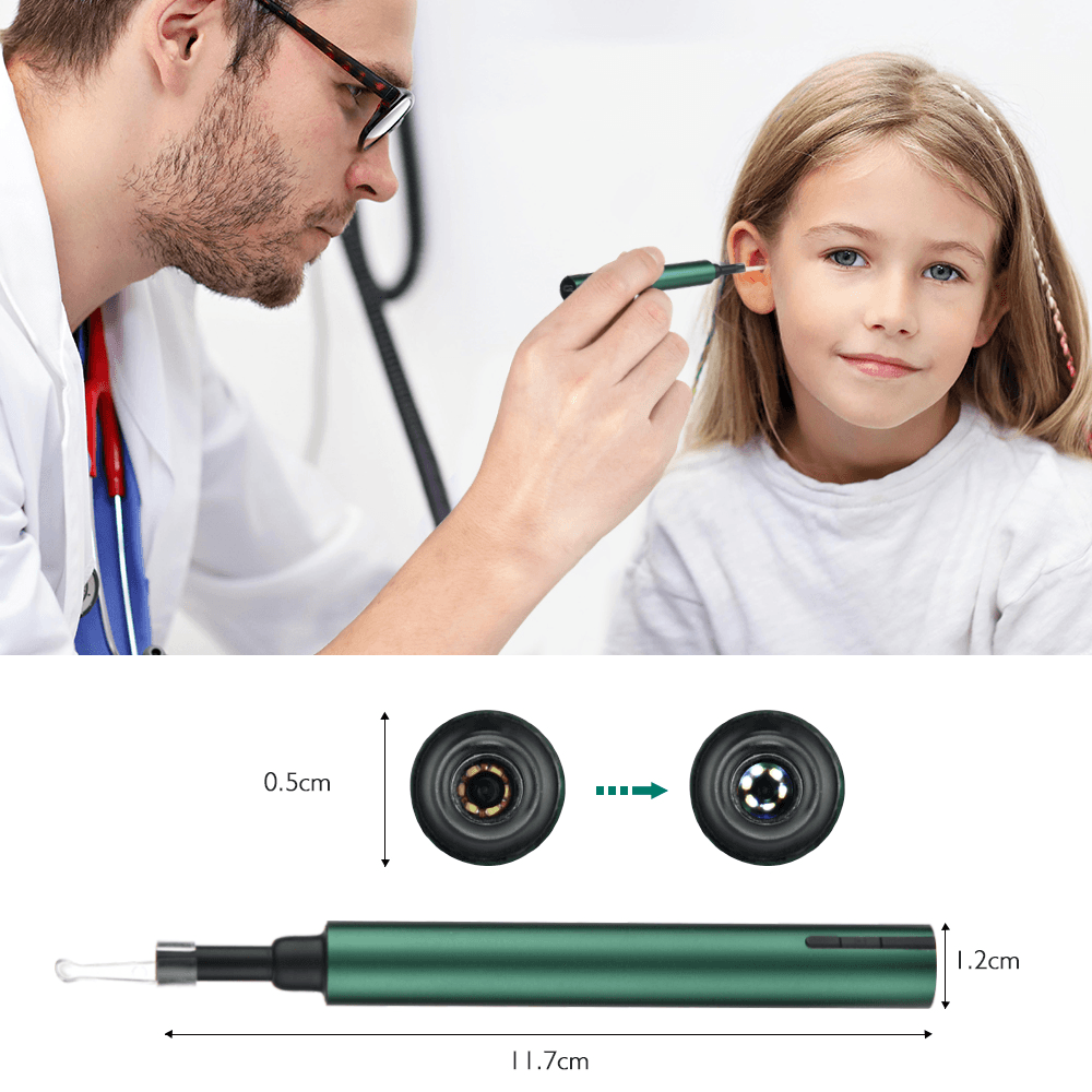 3,0 Mm Drahtlose Wifi Ohr Pick Otoskop Kamera Endoskop Leucht Ohr Wachs Reinigung Zähne Oral Inspektion Gesundheitswesen 3,0/5,0 MP