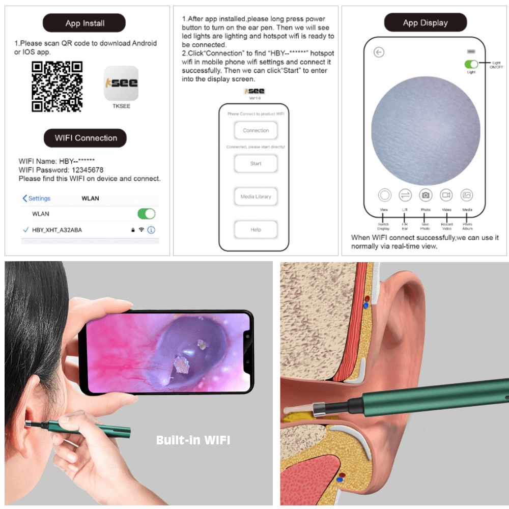 3,0 Mm Drahtlose Wifi Ohr Pick Otoskop Kamera Endoskop Leucht Ohr Wachs Reinigung Zähne Oral Inspektion Gesundheitswesen 3,0/5,0 MP